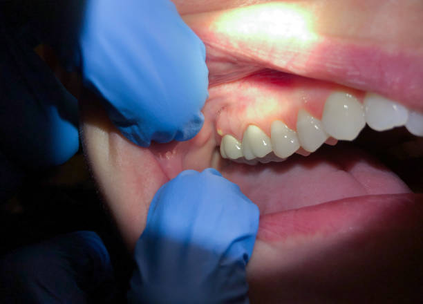 Best Broken or Cracked Tooth Emergency Dentist in Gray Summit, MO